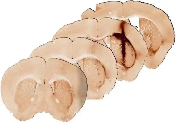 8bdf9cba1b9455fa535e476af9cfa331.jpg